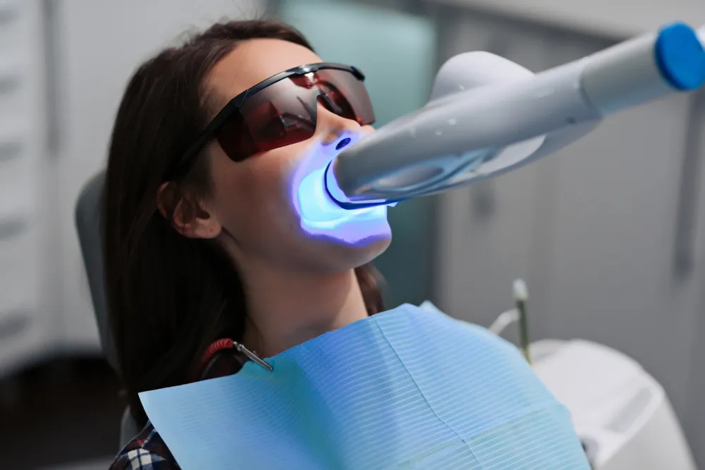 30370 laser whitening treatment teeth 1