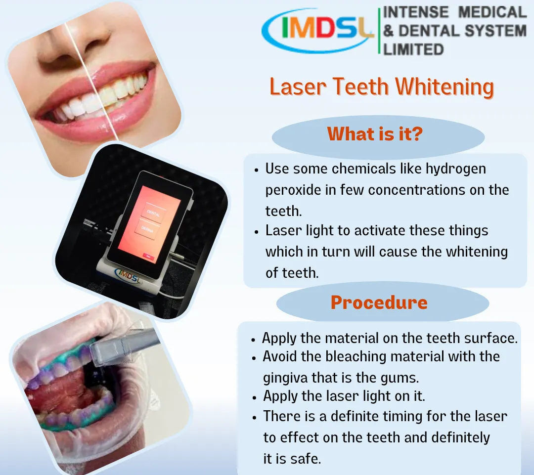 /img/30370-laser-whitening-treatment-teeth-7.webp