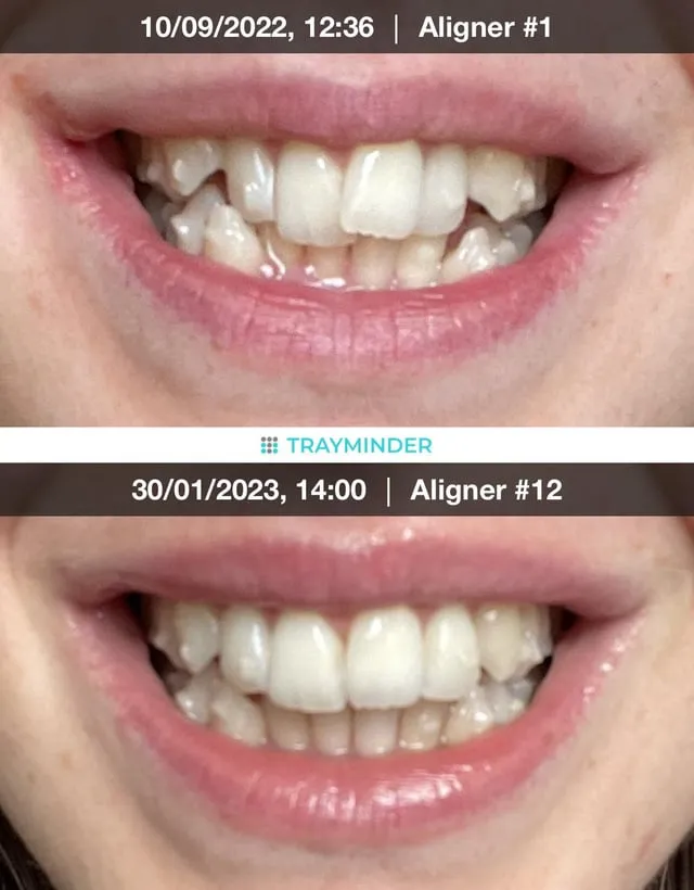 30378 goby whitening gel