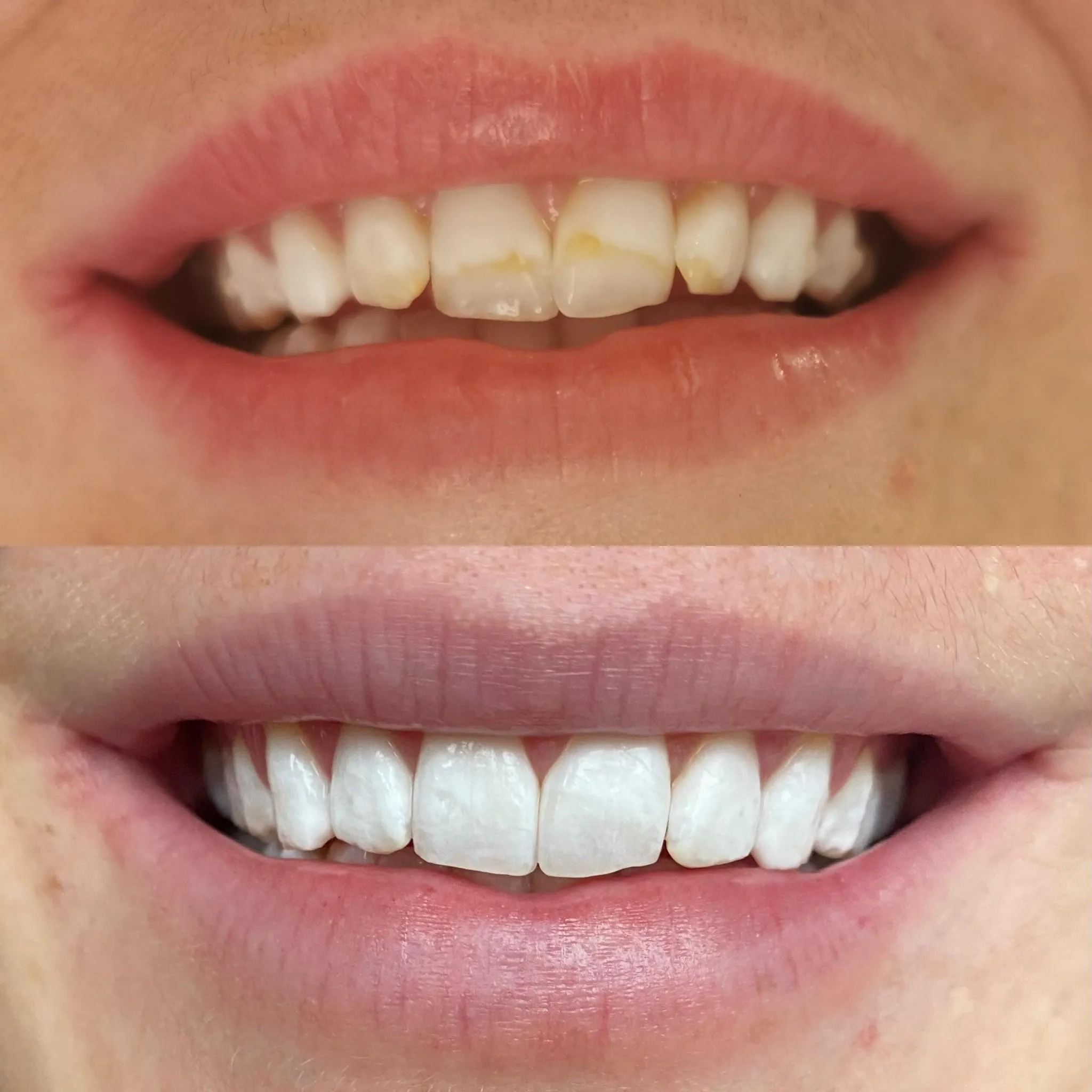 30378 smile brilliant whitening