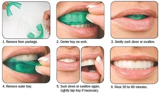 30379 opalescence products