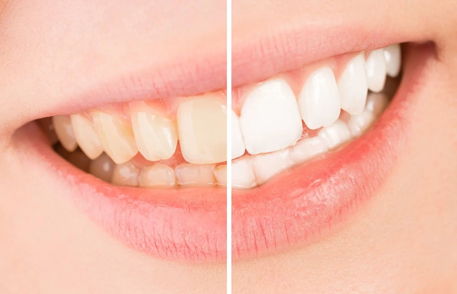 /img/30382-coffee-teeth-whitening-7.webp