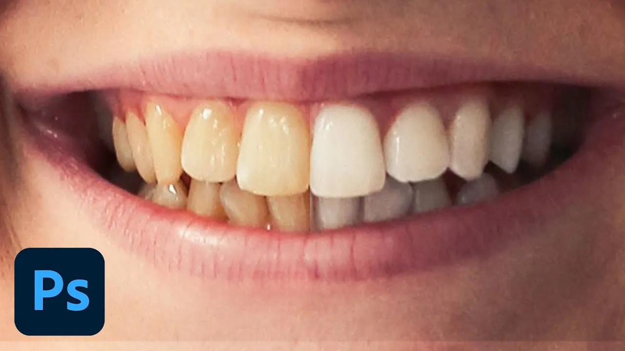30389 photoshop teeth whitening example