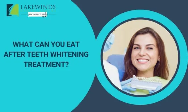 30394 teeth whitening avoid