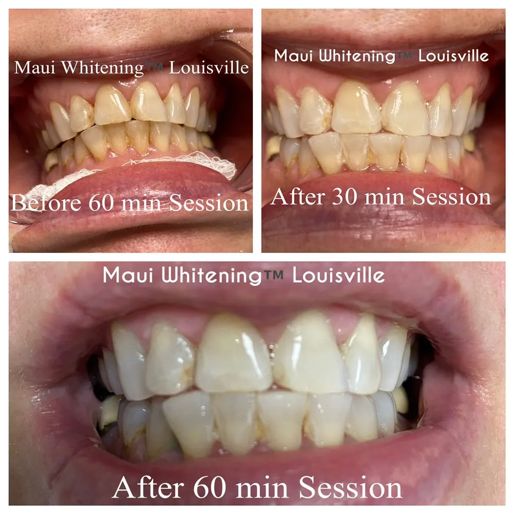 30398 brushing and flossing