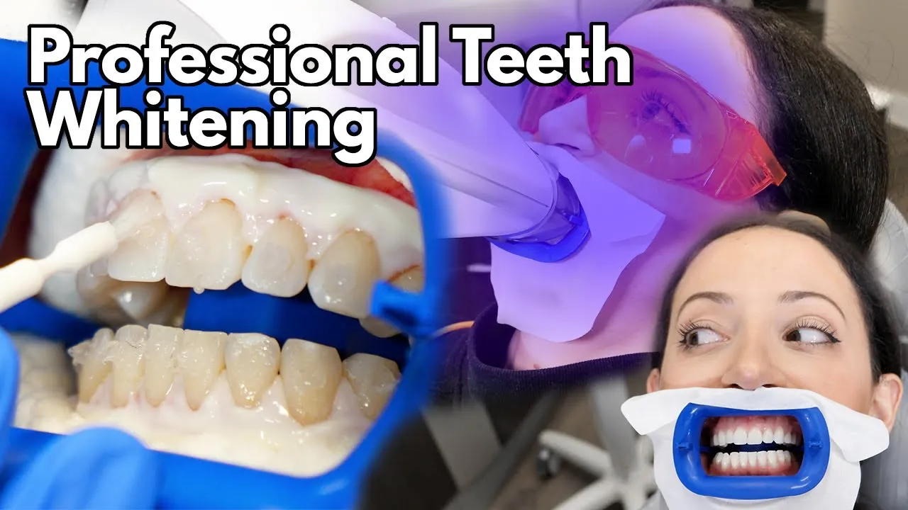 30399 teeth whitening importance