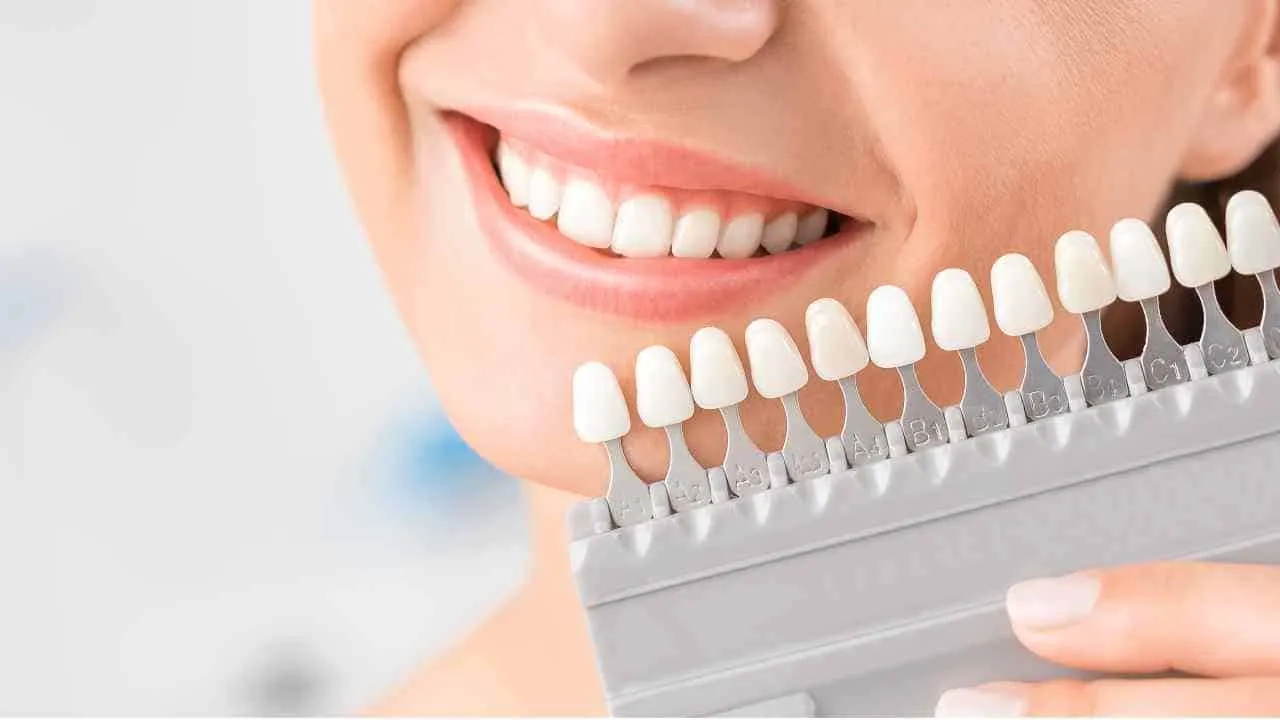 30409 teeth whitening maintenance