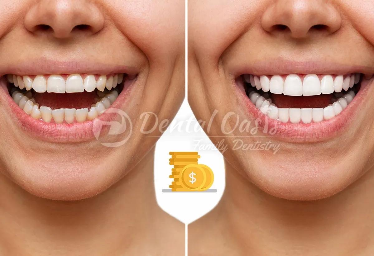 30409 teeth whitening tulsa 1
