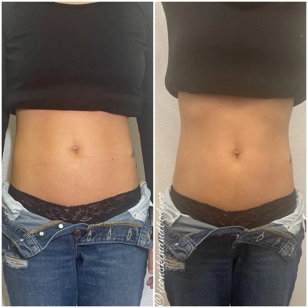 30411 confident smile