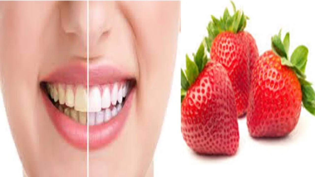 /img/30417-teeth-whitening-comparison.webp