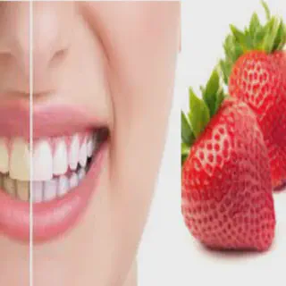 /img/30417-teeth-whitening-comparison.webp