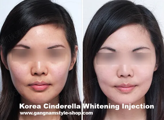 30422 skin whitening surgery surgeon fees