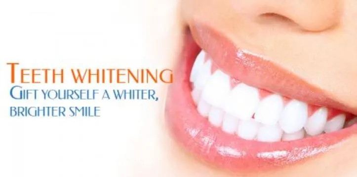 30426 professional teeth whitening