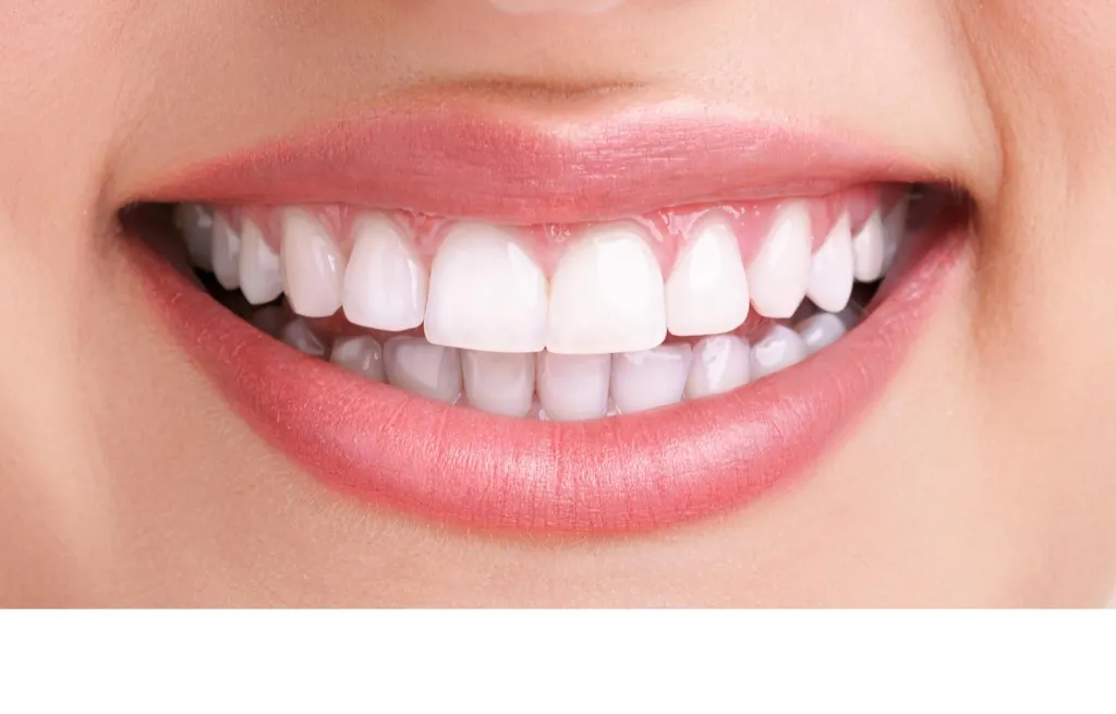30428 wellington teeth whitening dentist