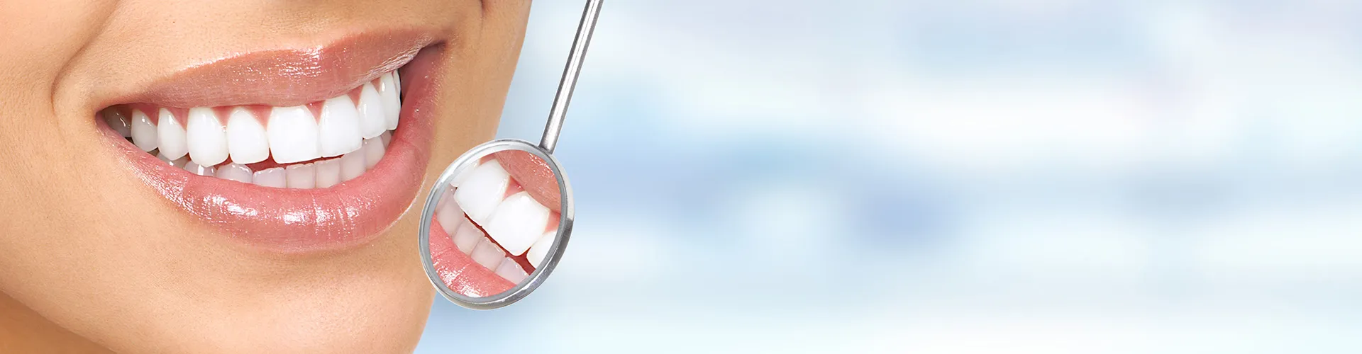 30429 professional teeth whitening