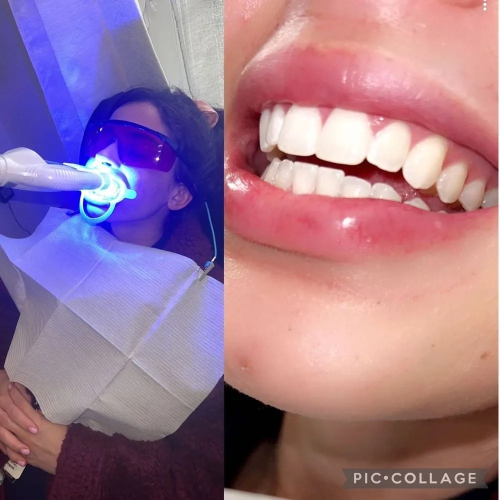 30429 teeth whitening riverside ca 1