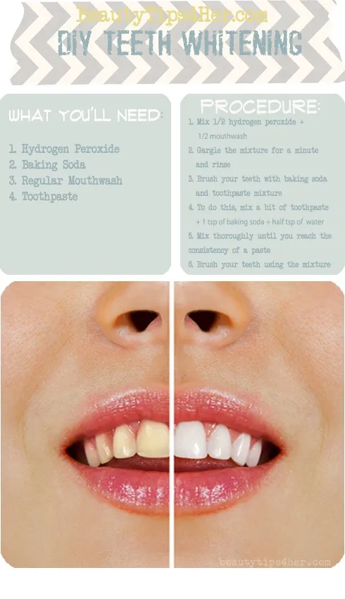 30431 strawberry teeth whitening