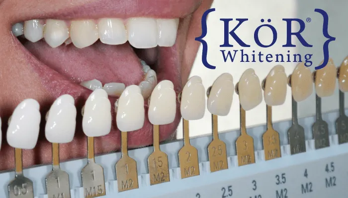 /img/30432-teeth-whitening-comparison.webp