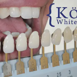 /img/30432-teeth-whitening-comparison.webp