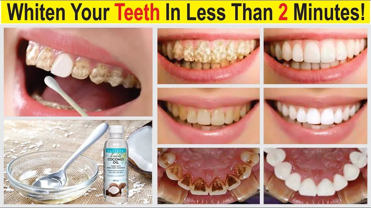 30433 coconut oil turmeric teeth