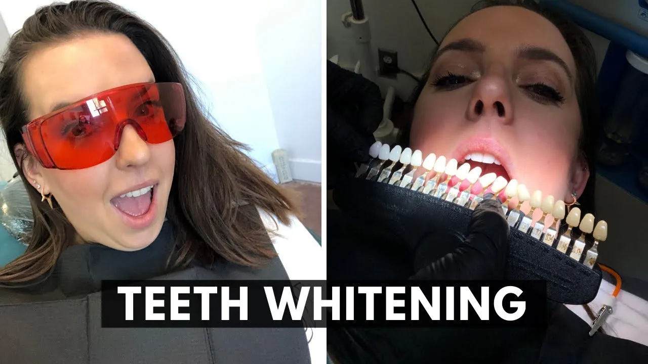 30446 bay area teeth whitening image3