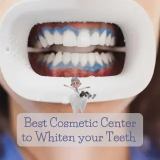 /img/30446-bay-area-teeth-whitening-image7.webp