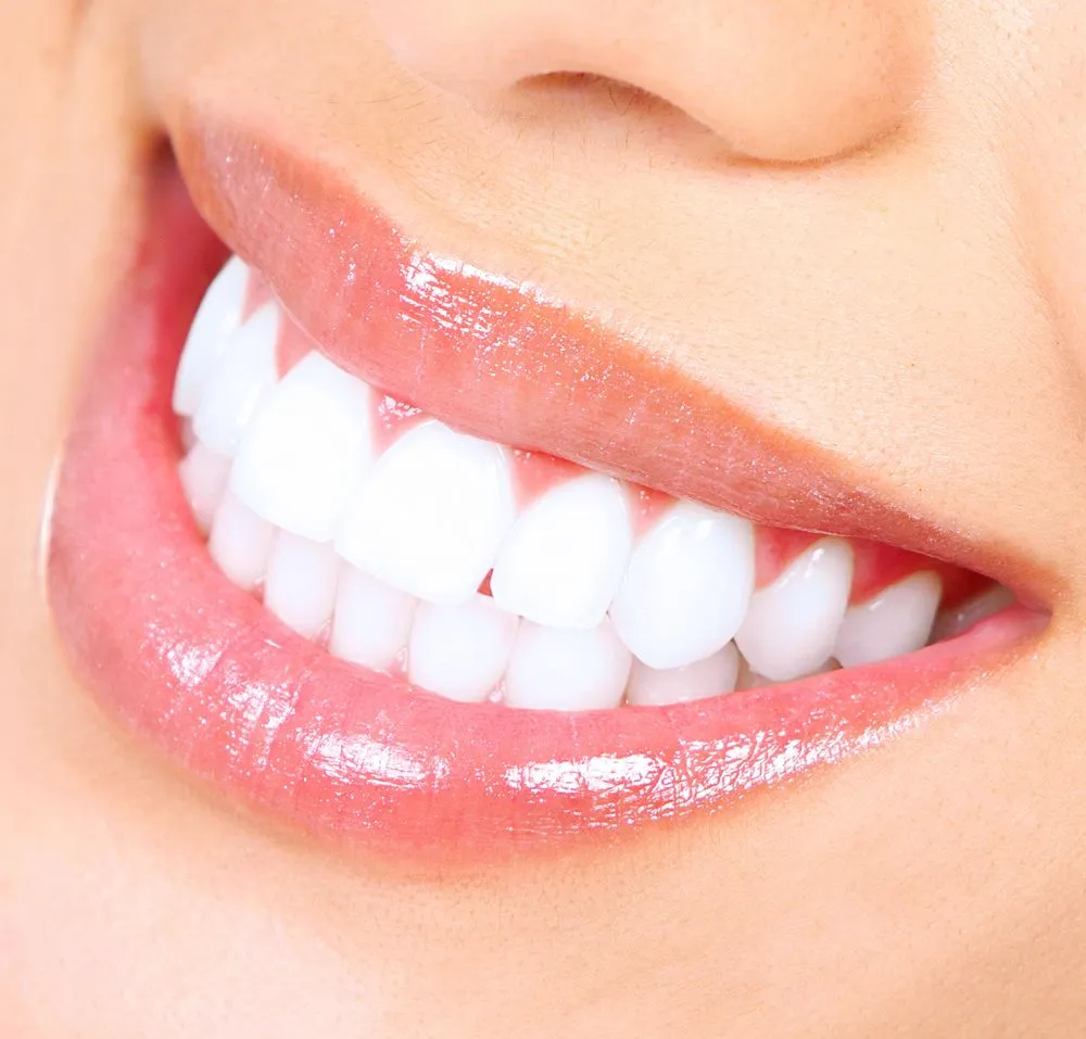 30453 tulsa tooth whitening