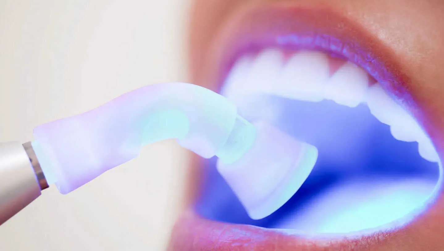 30459 turkey teeth whitening cost factors