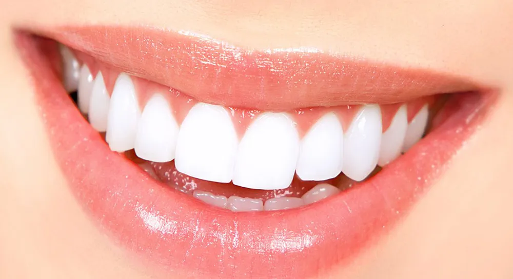 30459 turkey teeth whitening smile