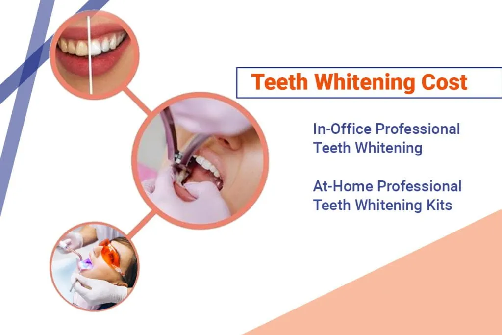 30465 teeth whitening maintenance