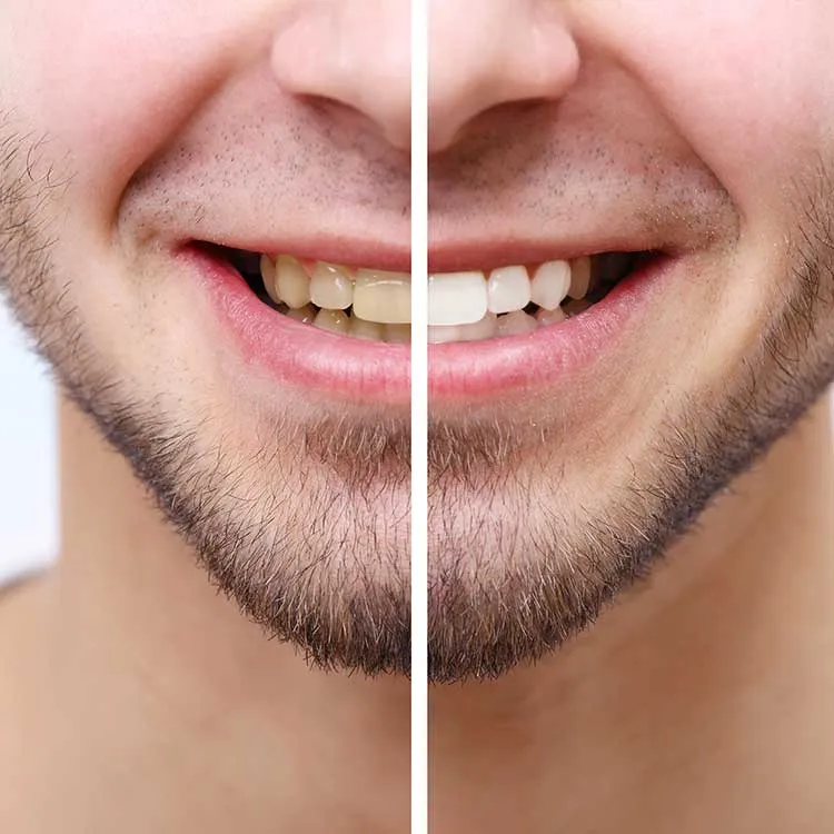 30468 dentist san francisco