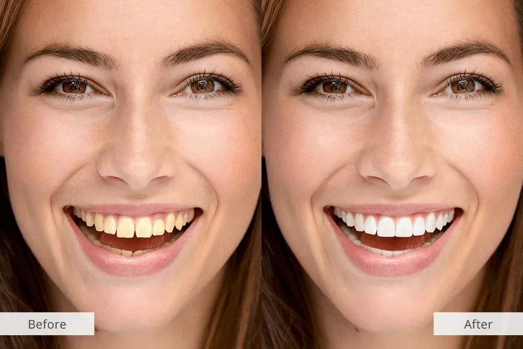 30469 teeth whitening app tools