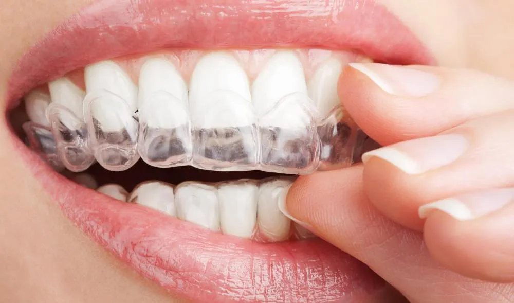 30480 gentle brushing technique