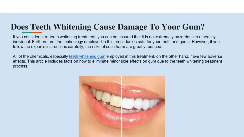 30480 teeth whitening gum damage