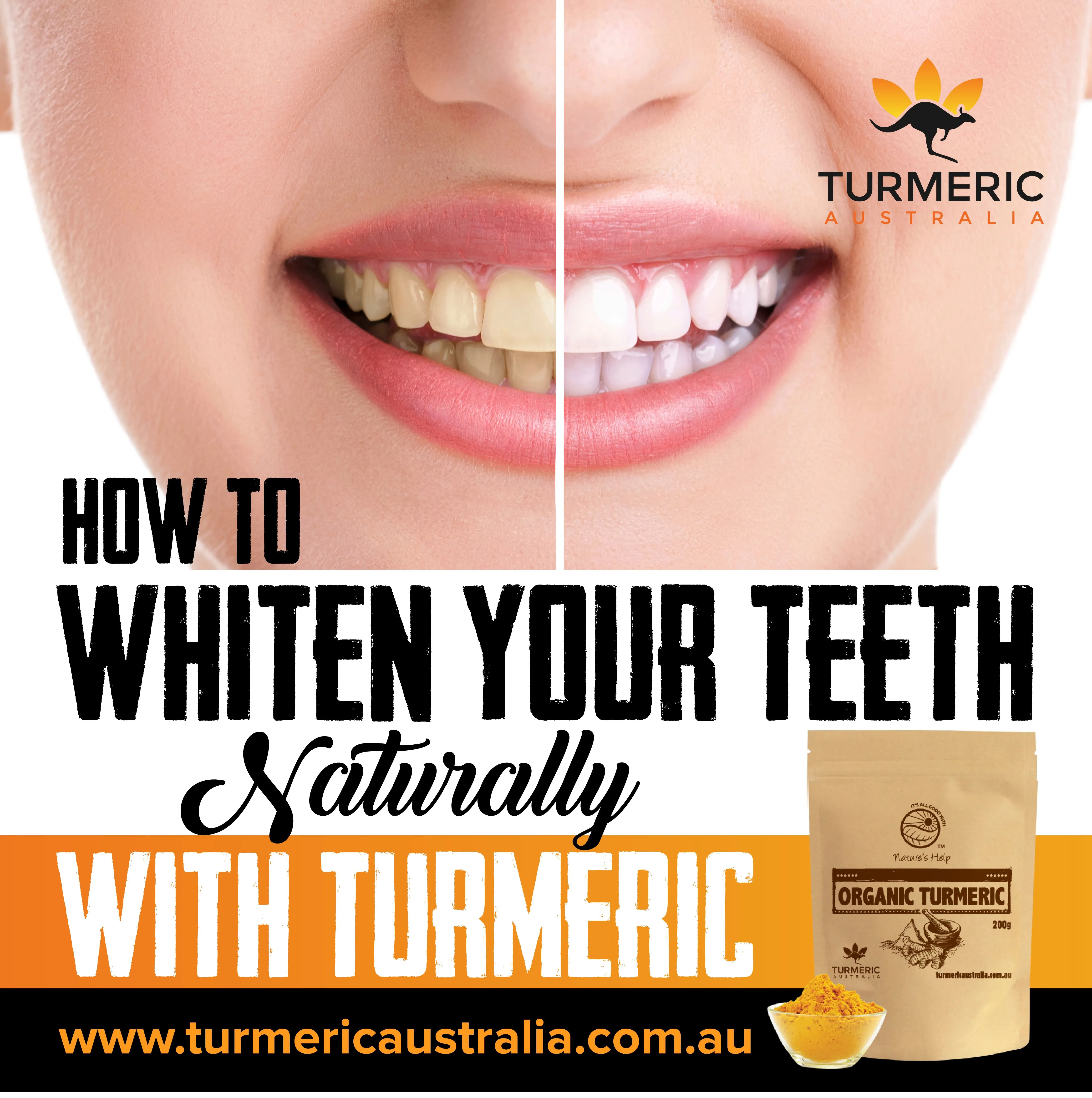 30488 teeth whitening comparison