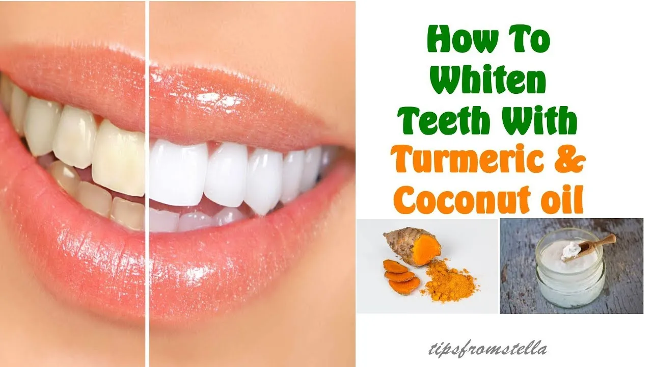 30488 teeth whitening process
