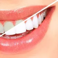 30490 teeth whitening appointment process