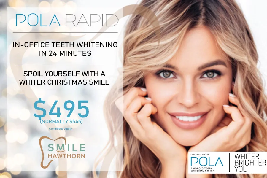 30491 teeth whitening holiday specials 4