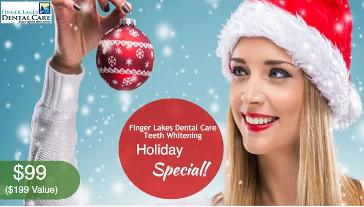 30491 teeth whitening holiday specials 5