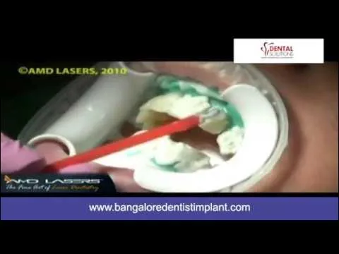 30493 confident smile after teeth whitening