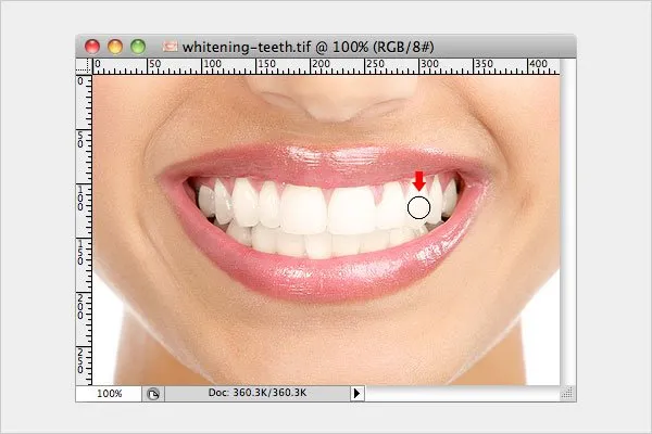 /img/30497-dental-checkup.webp