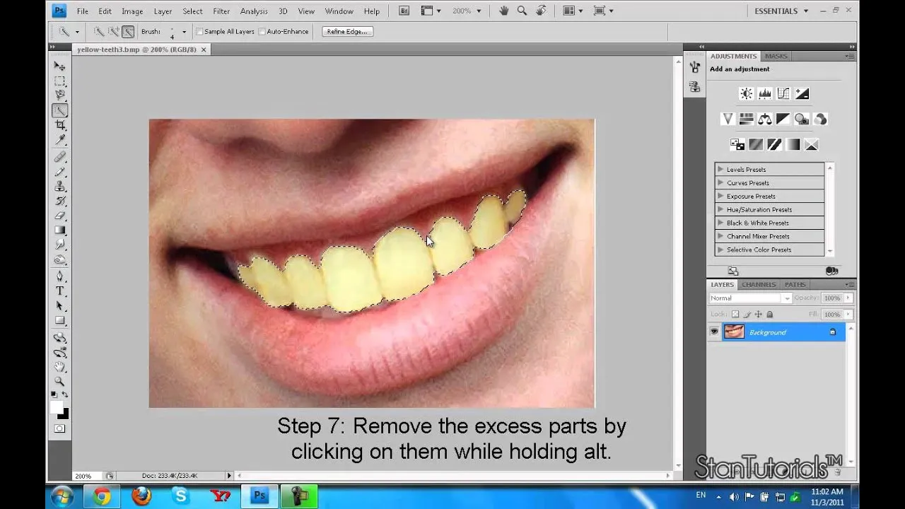 30497 home teeth whitening