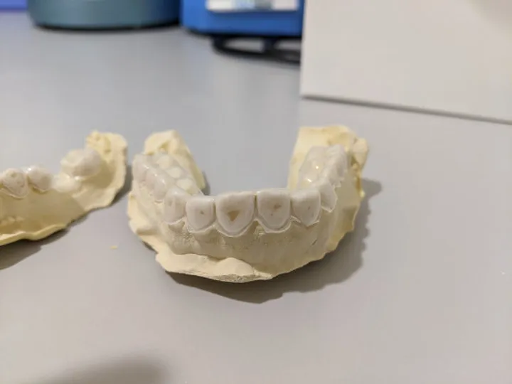 30500 drying whitening trays