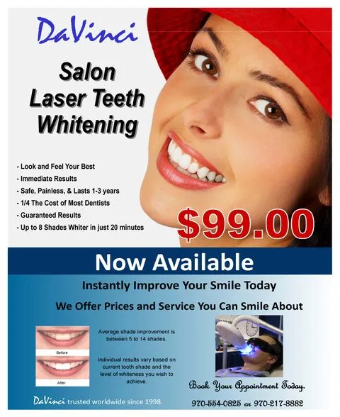 /img/30509-professional-teeth-whitening-tools.webp
