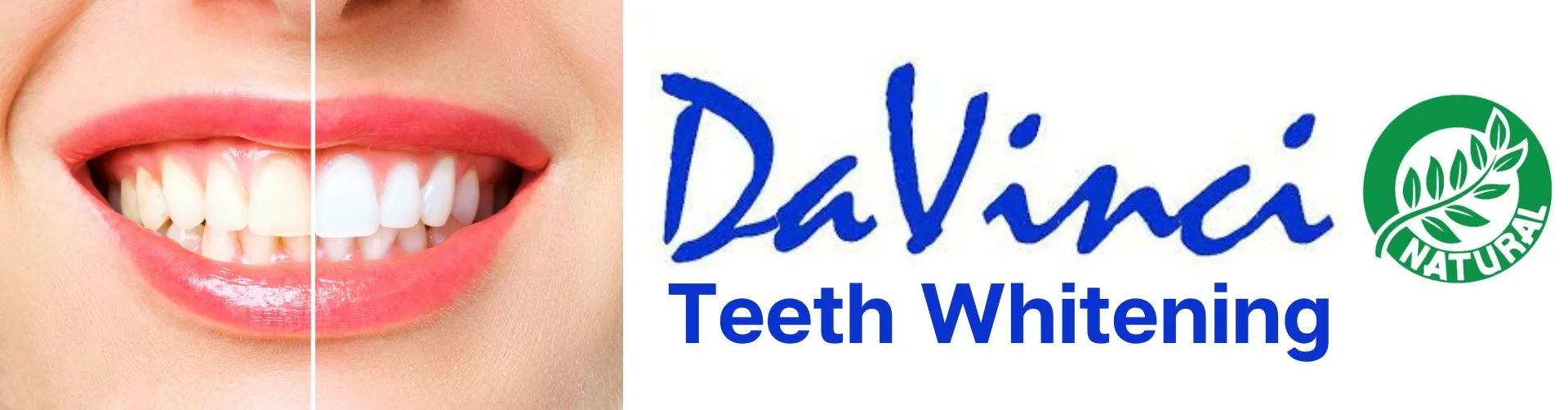 30509 teeth whitening training