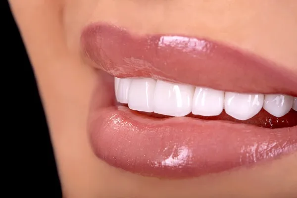 30510 teeth whitening sioux falls sd cost