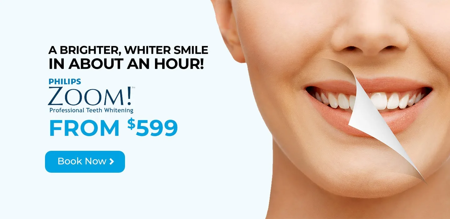 30517 zoom whitening cost