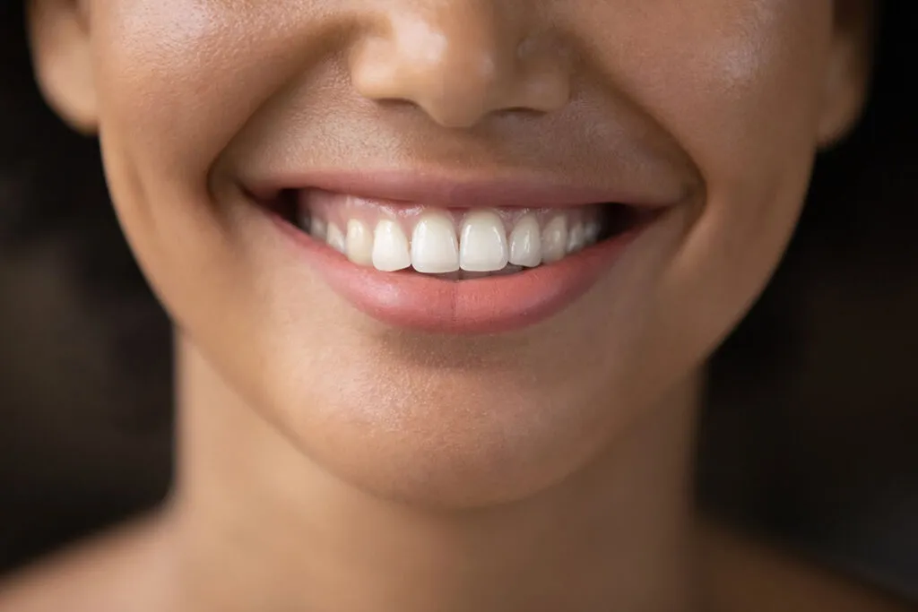 30522 teeth whitening beverly hills ca image1
