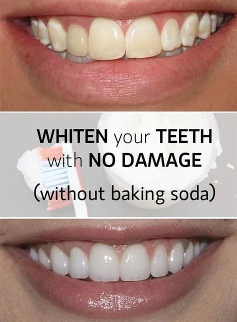 30525 baking soda teeth whitening