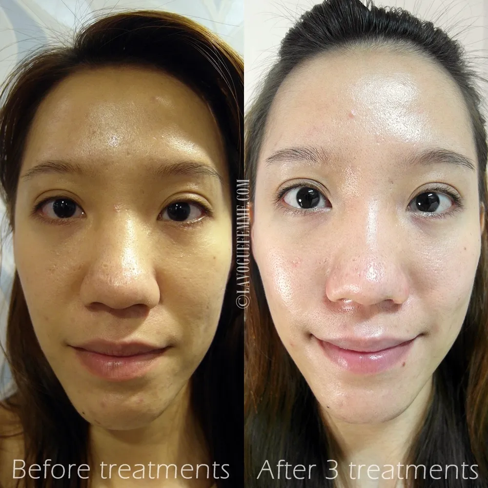 30527 post surgery skin care